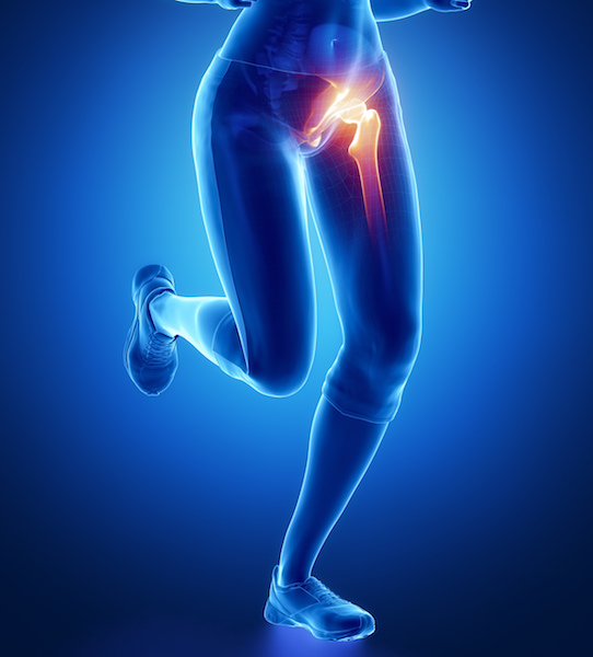 How Will You Know If You Need a Hip Replacement?